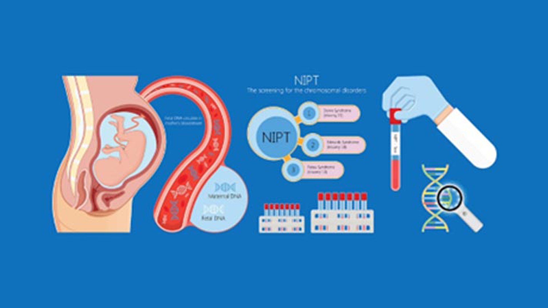 SB Pre Gene PGTA & NIPT